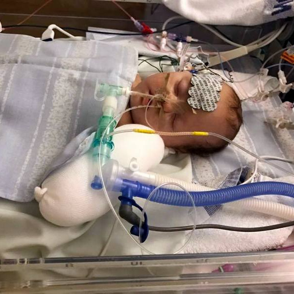 Jökull Máni sefur vært eftir eftir hjartaaðgerðina sem tókst vel. Mynd: Anna Baldvina.