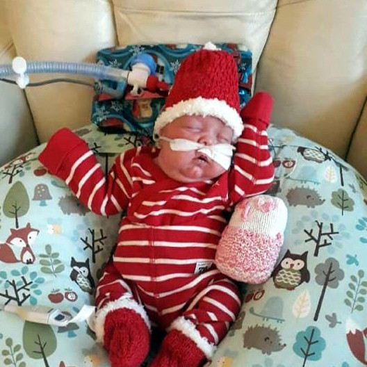 Agnarögn hefur dafnað vel. Hér er hún í jóladressinu sínu. Mynd af Facebooksíðunni Styrktarsíða fyrir Agnarögn og foreldra hennar.