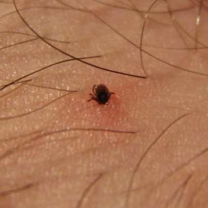 Skógarmítill að breiðast út um landið – Mikilvægt að kynna sér hættuna sem fylgir biti