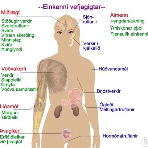 Vefjagigtarfræðsla með líkamsstöðugreiningu
